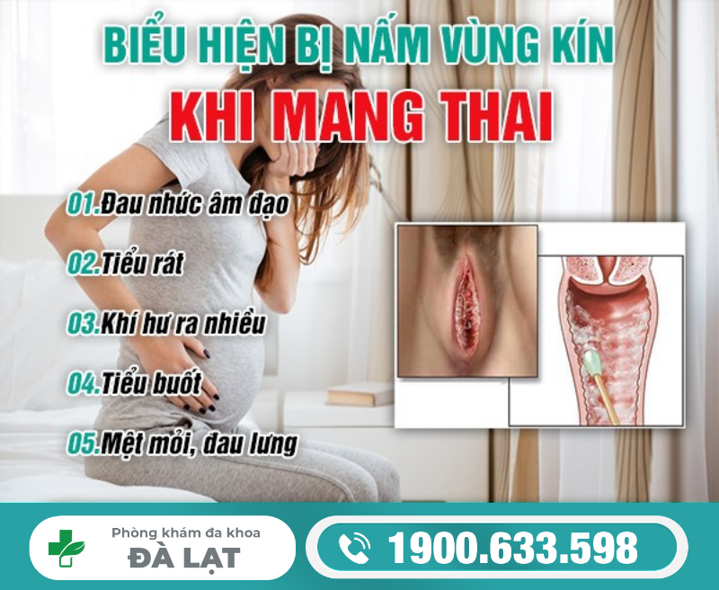 Hình ảnh minh họa